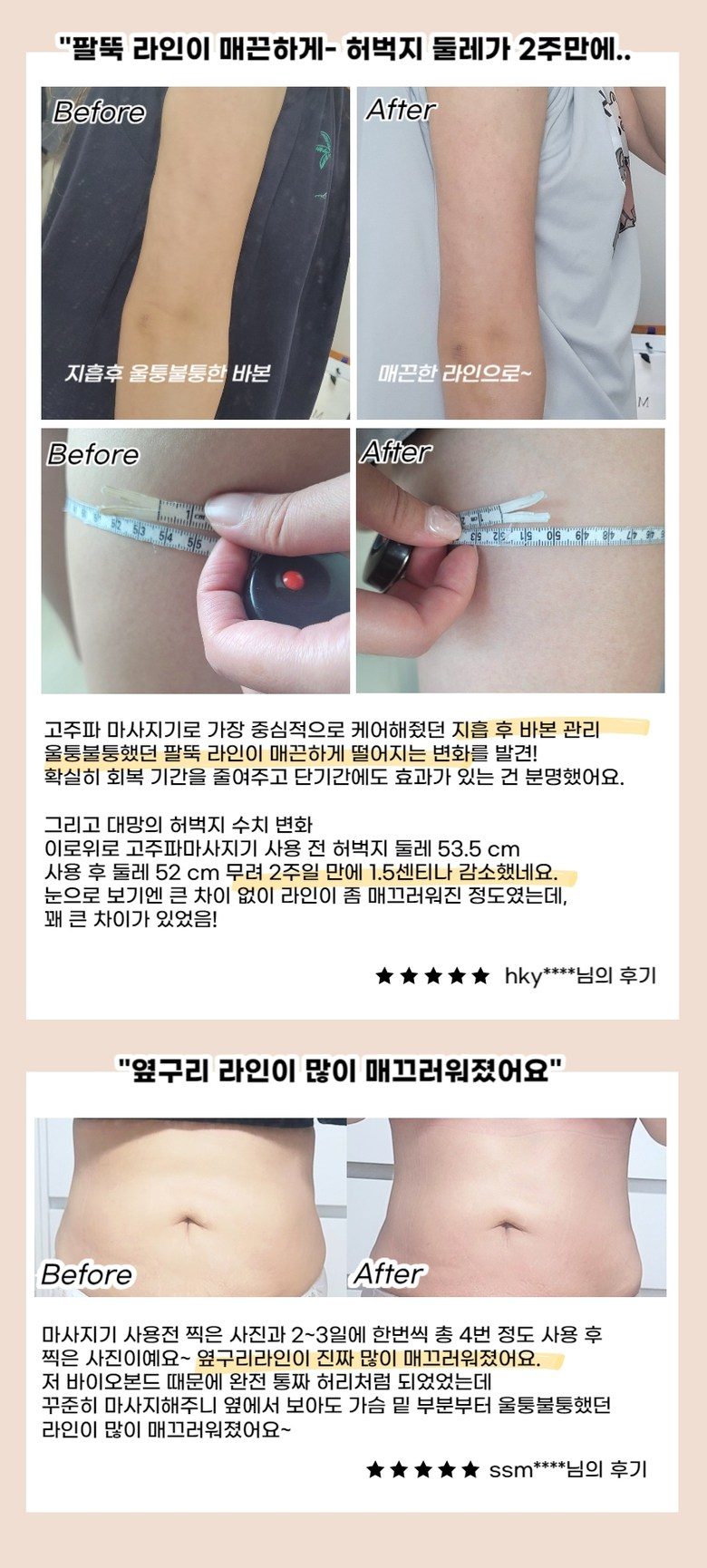 이로위로 바디 고주파 마사지기 온열 갈바닉 초음파 바본관리 가정용고주파기 홈케어 뷰티디바이스